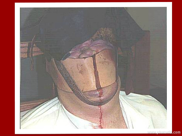 Bandaged man hat blood stained free wallpaper for desktop - medium preview image