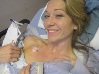 Woman hospital bed bruised arm - upper free wallpaper