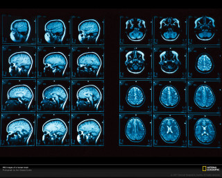 Mri images blue light black - a picture of a bunch free wallpaper
