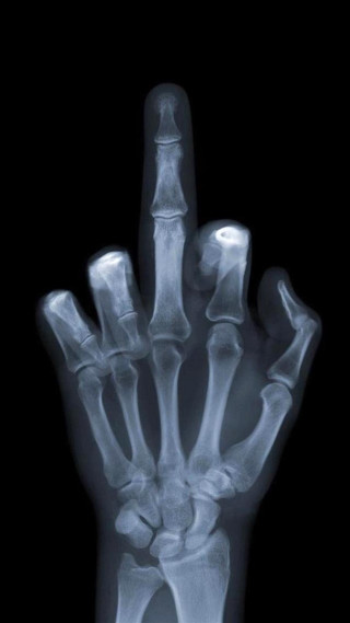 Hand xray thumb area details - a hand free wallpaper for mobile