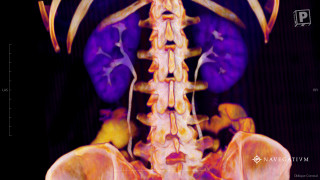 Skeleton purple yellow orange black - correct free wallpaper