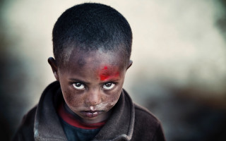 Young boy red spot serious - spot free wallpaper