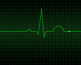 Green heartbeat cardiogram black background - a black background photo free wallpaper