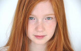 Close up freckled person freckles - freckle free wallpaper for desktop